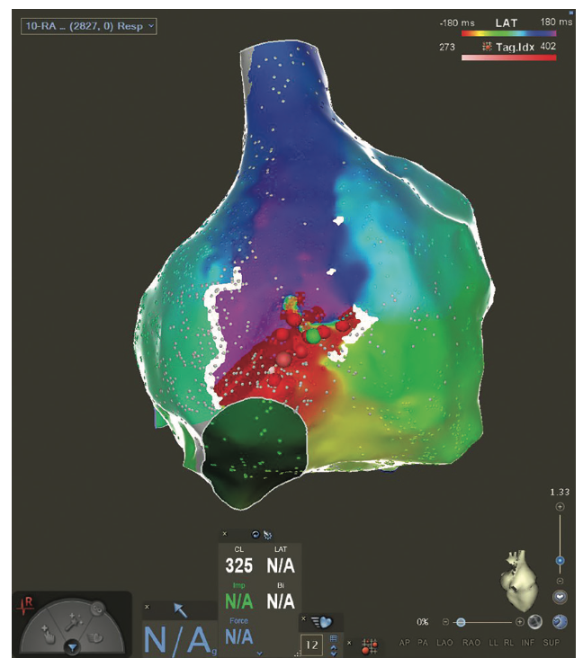 Phang Ablation Figure 1D