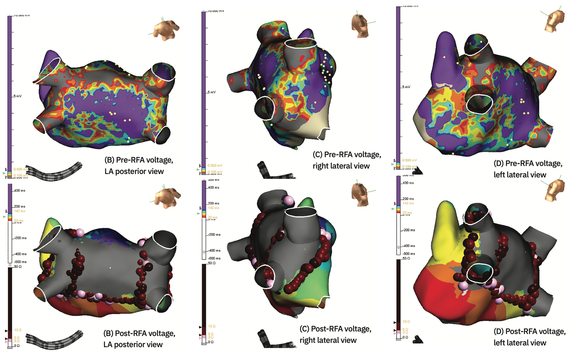 Phang Ablation Figure 2B-D