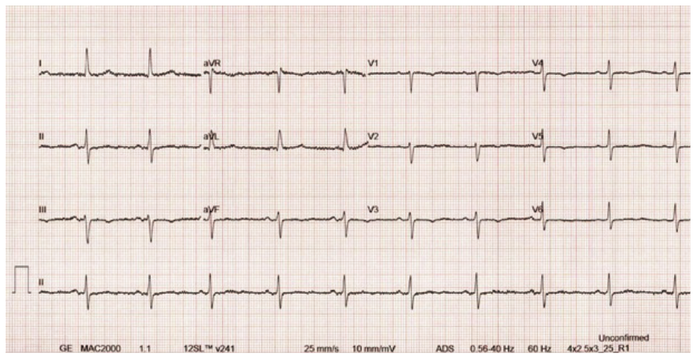 Phang Ablation Figure 2E