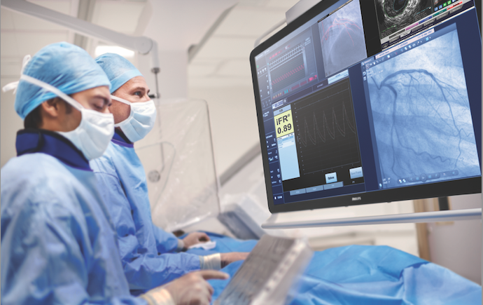 Philips instantaneous wave-free ratio (iFR) 