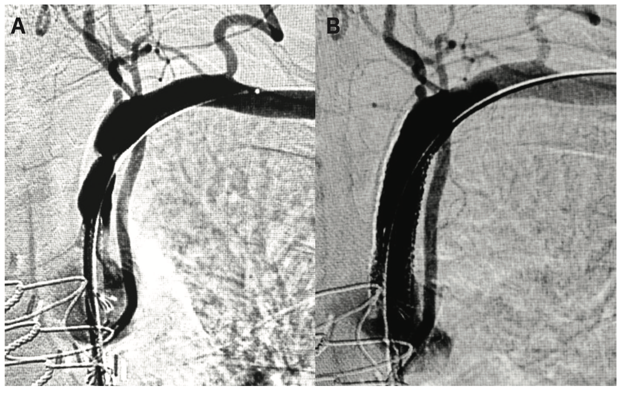 Prasad Bilateral Femoropopliteal Figure 3