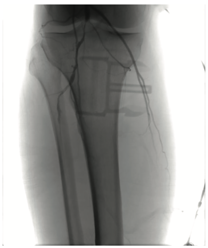 Pratsos Serranator Figure 1