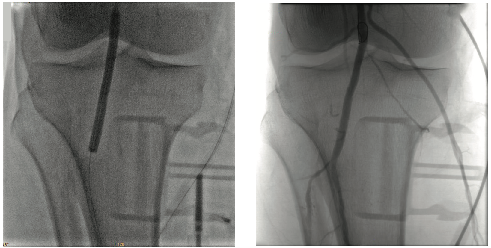 Pratsos Serranator Figure 2