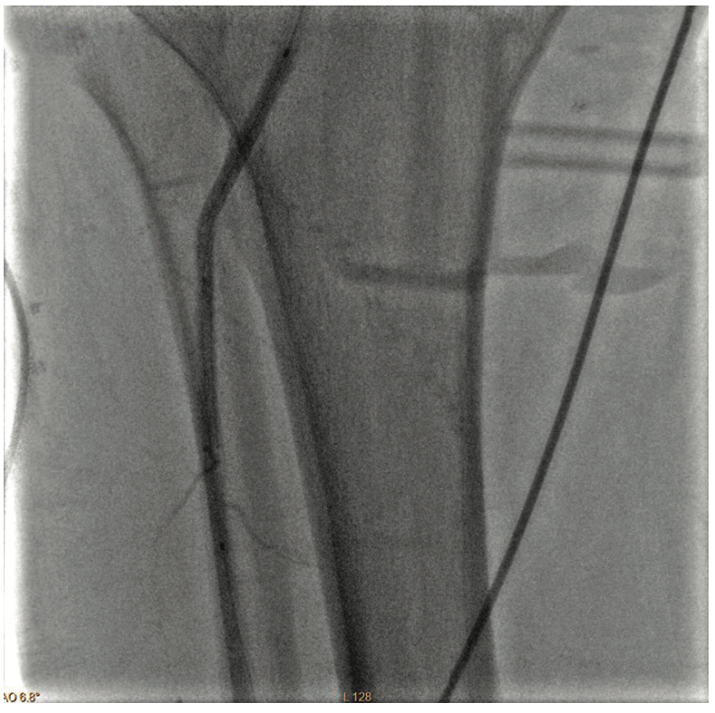 Pratsos Serranator Figure 3