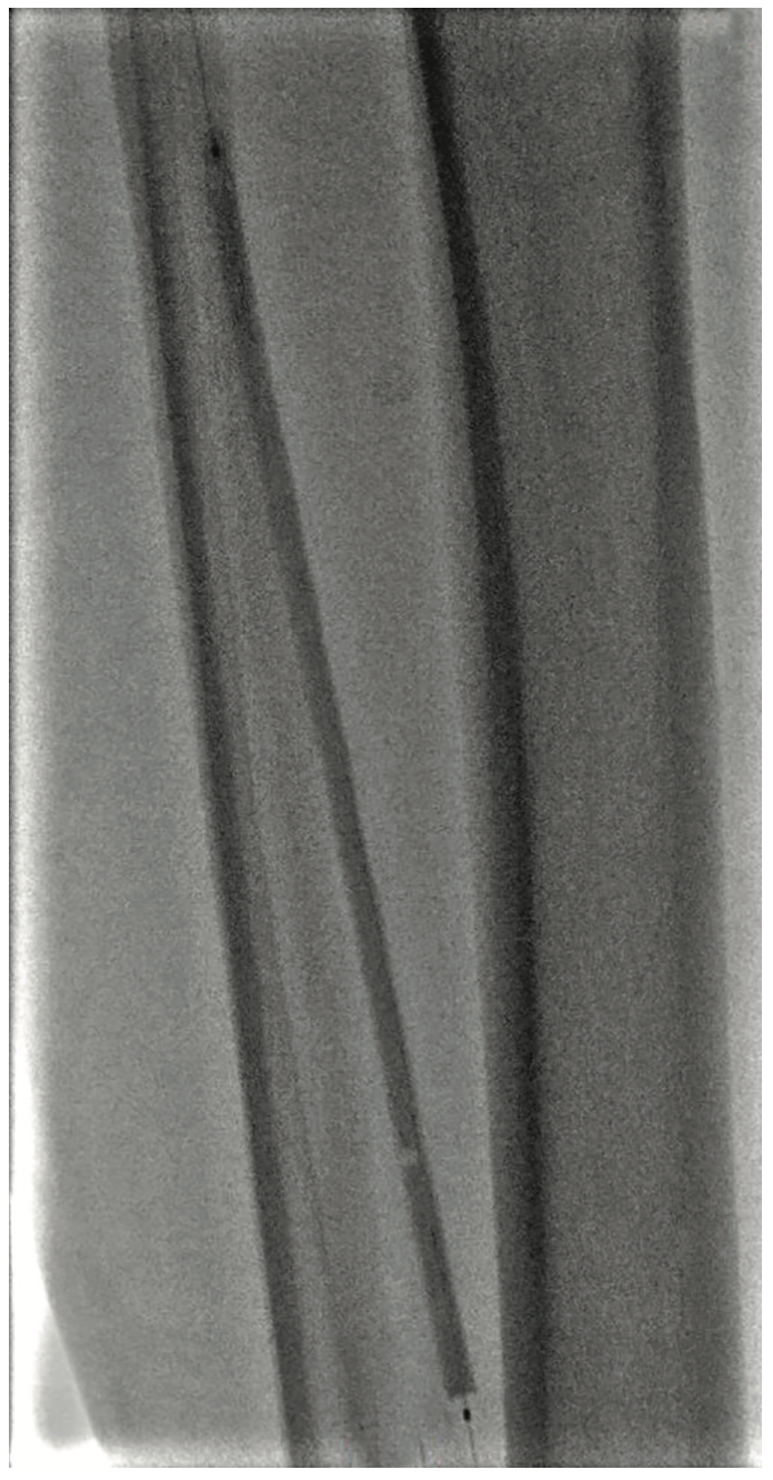 Pratsos Serranator Figure 4