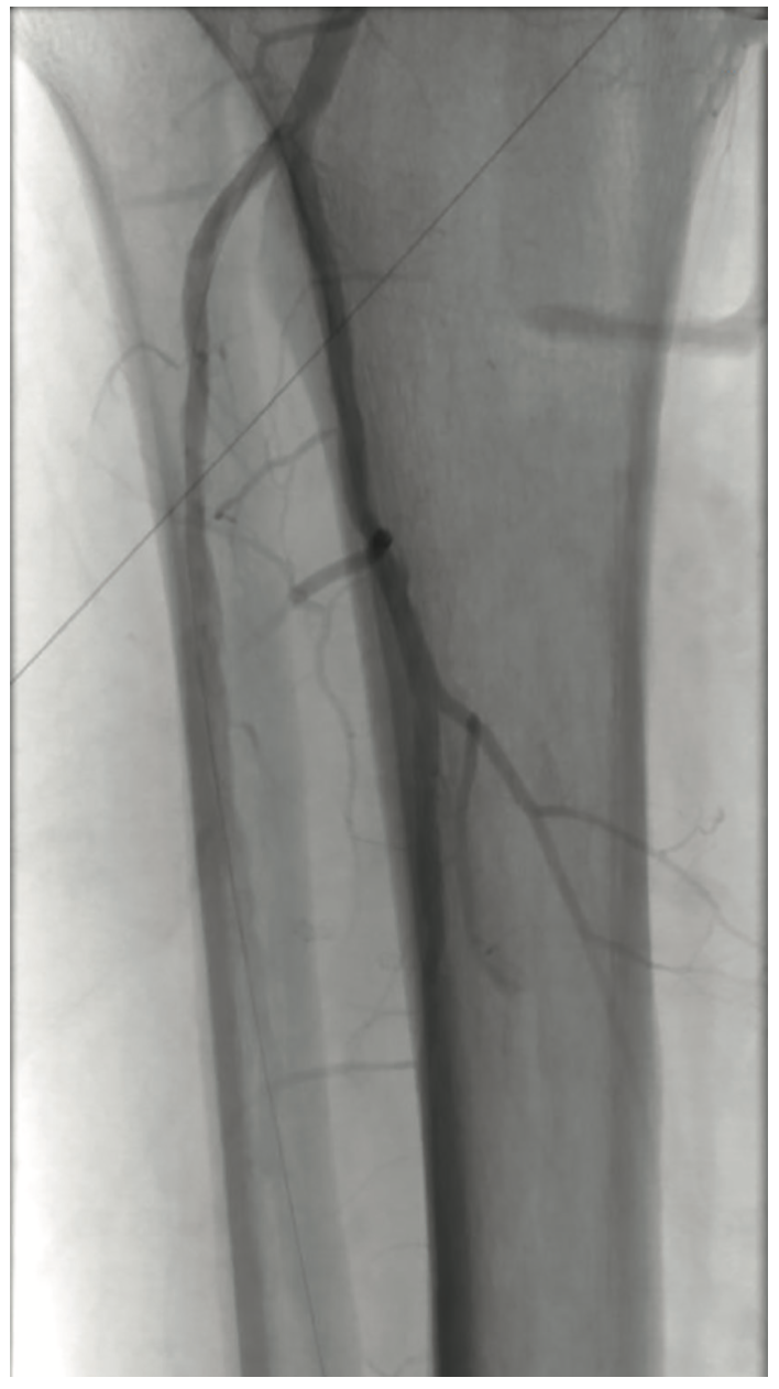 Pratsos Serranator Figure 5