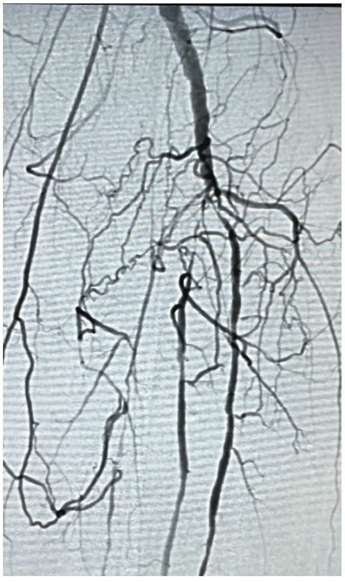 Pratsos Serranator Figure 6