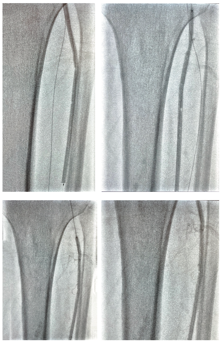 Pratsos Serranator Figure 7