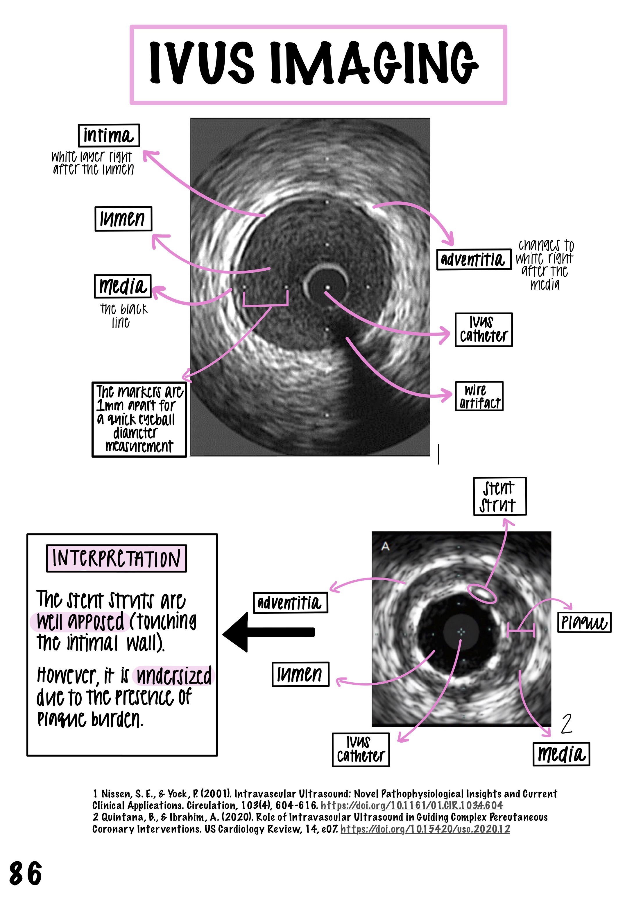 Figure 3. Image featuring a page from The Cath Lab Visual Orientation Manual featuring IVUS imaging.
