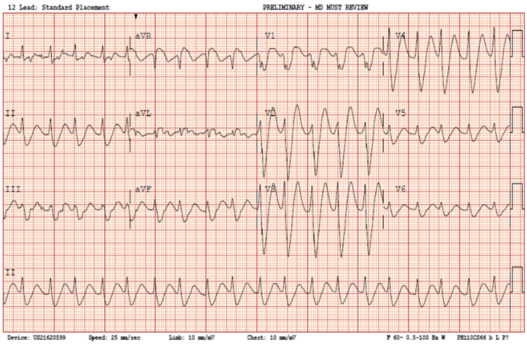 Prousi - June 2024 - Fig 1