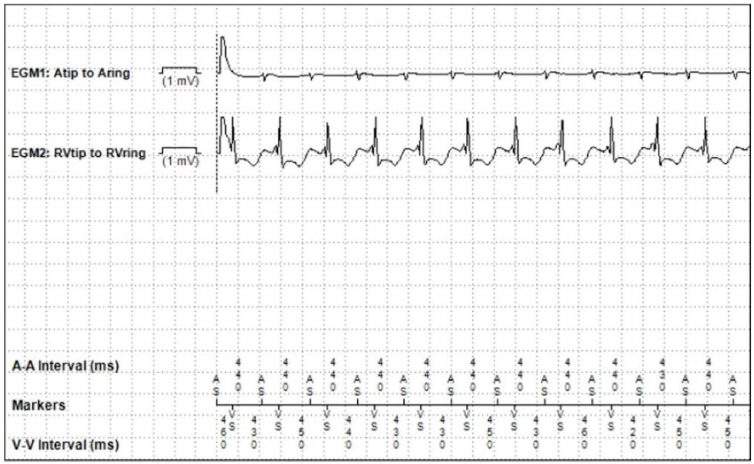 Prousi - June 2024 - Fig 3