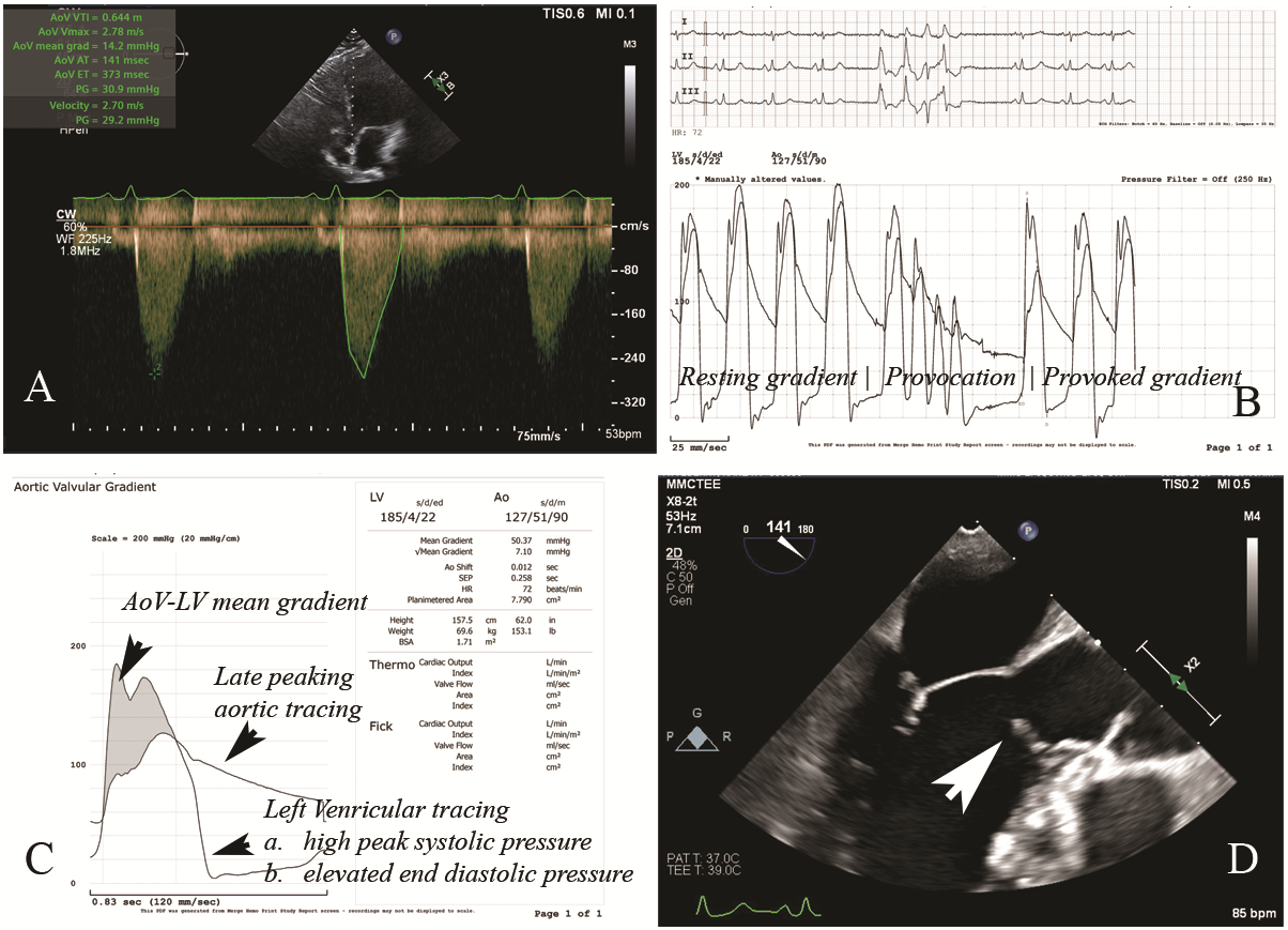 Figure. Cardiac imaging and catheterization findings