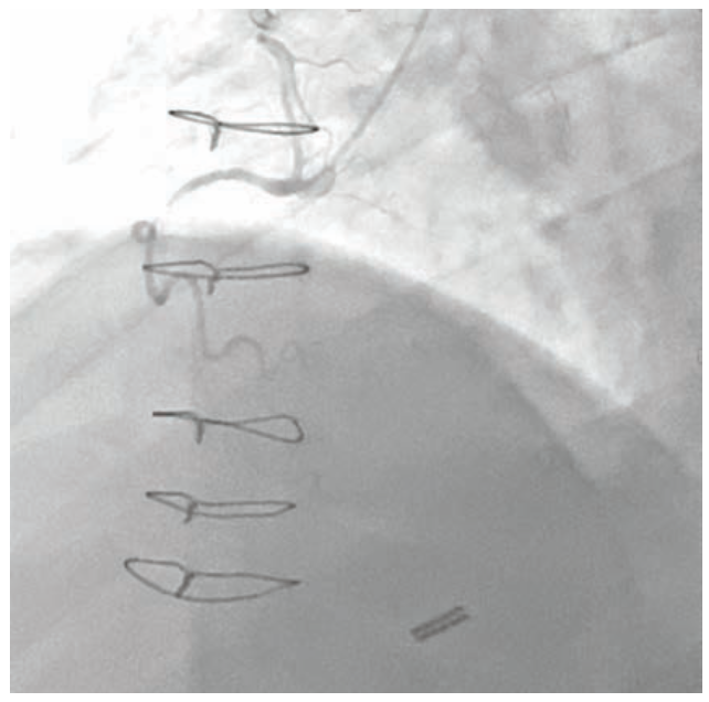 Raj Complex PCI Figure 1