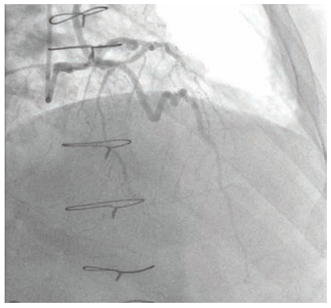 Raj Complex PCI Figure 2