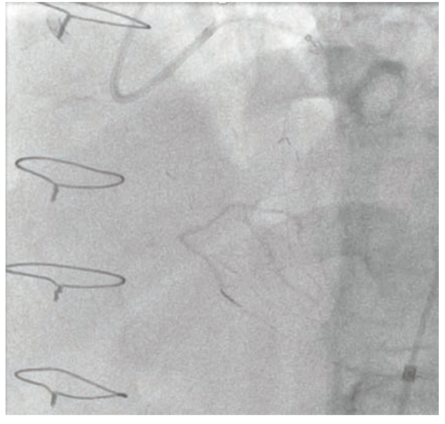 Raj Complex PCI Figure 3