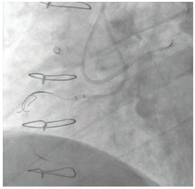 Raj Complex PCI Figure 4