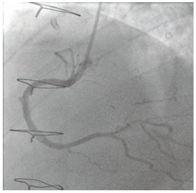 Raj Complex PCI Figure 5