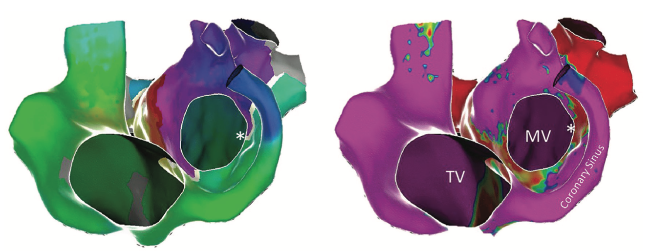 Richardson Ablation Figure 1