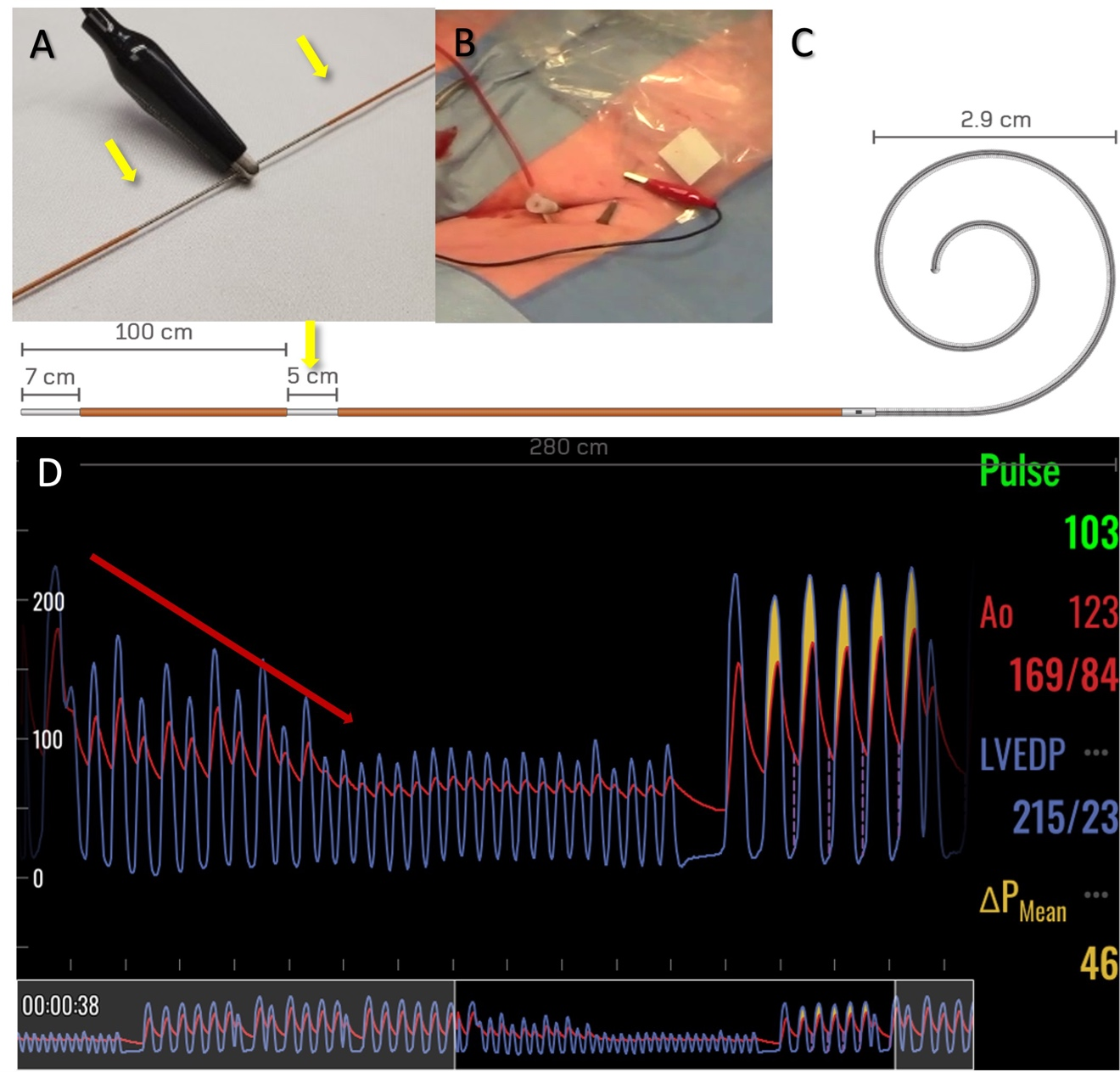 Figure 2. Dedicated pacing capabilities of the SavvyWire