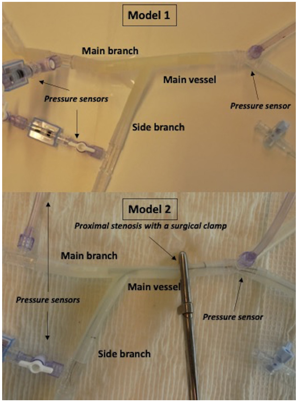 Rubimbura Bifurcation-PCI Figure 1