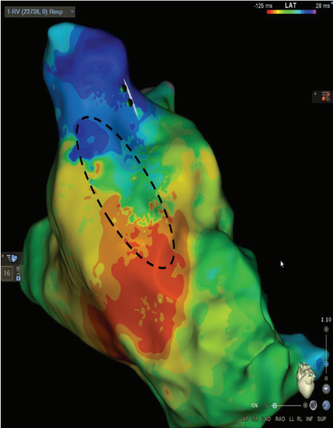 Russell-Fig2-EP-Aug 2025.png 