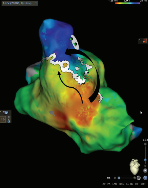 Russell-Fig3-EP-Aug 2025.png 