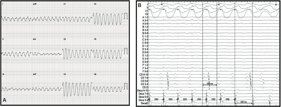 Russell-Fig4-EP-Aug 2025.png 