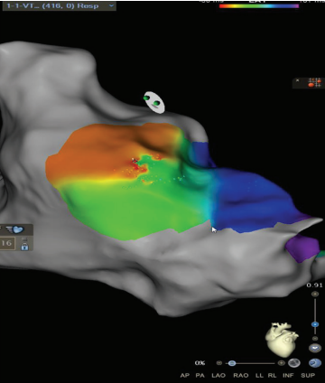 Russell-Fig5-EP-Aug 2025.png 