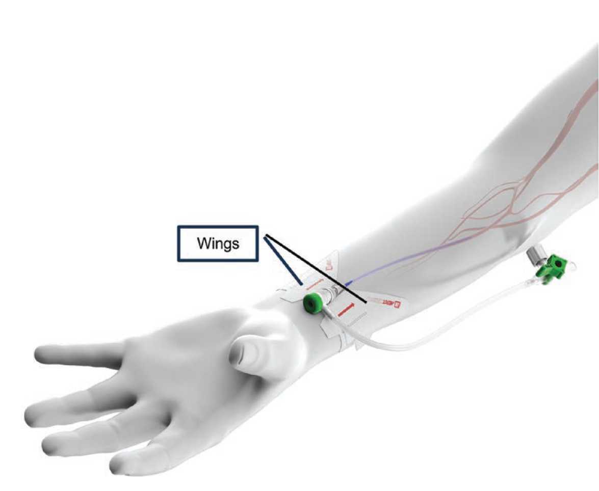 Sabharwal-Fig2-Nov 2025.png 