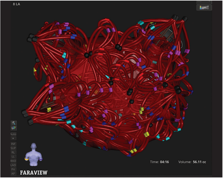 Sadhu-Fig1-EPLD-April 2026