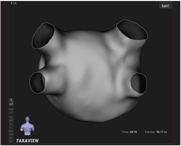 Sadhu-Fig2-EPLD-April 2026