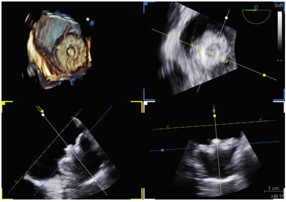 Sadhu-Fig3-EPLD-April 2026