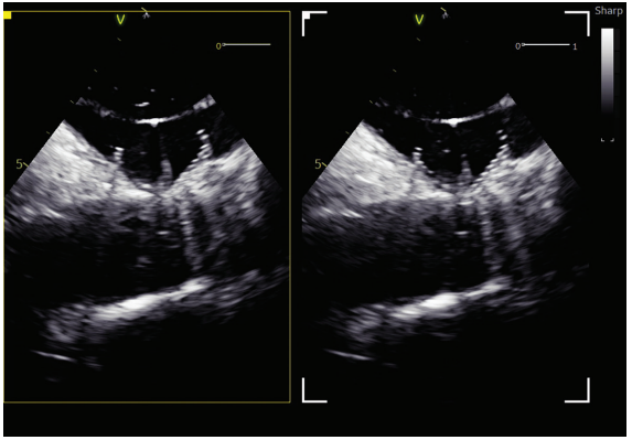 Sadhu-Fig4-EPLD-April 2026