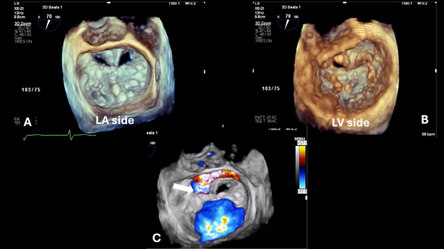 Figure 1. Three-dimensional zoom images .