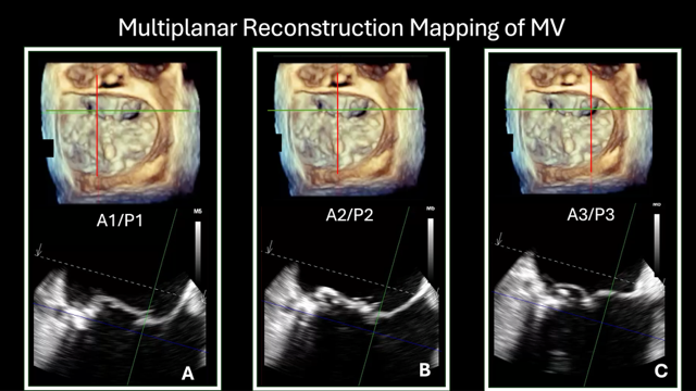 Figure 2. Multiplanar reconstruction.