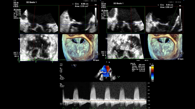 Figure 3. Multiplanar reconstruction
