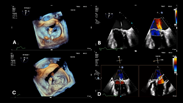 Figure 4. (A) Three-dimensional surgical view 