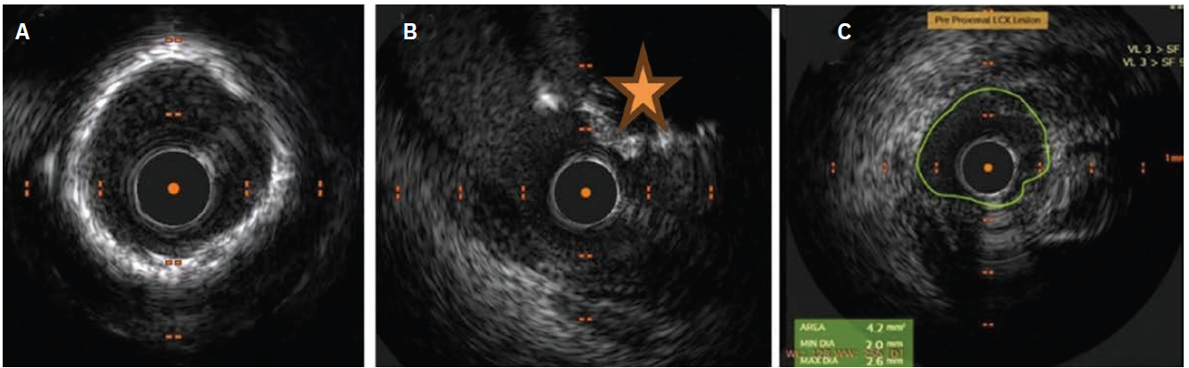 Sahoo,-Fig2-CLD-Sept 2025.png 