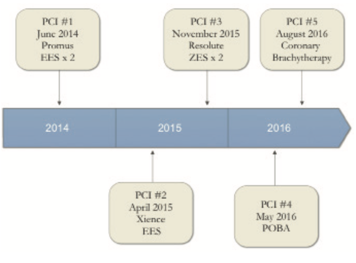 Savage Brachytherapy Figure 1