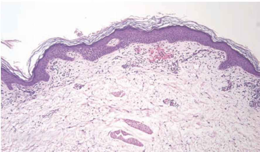 figure 2 dermdx June