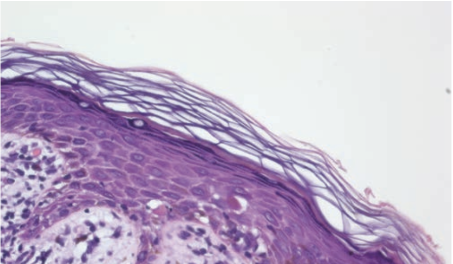 figure 3 dermdx june