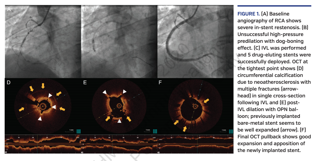 JIC La Manna Figure 1