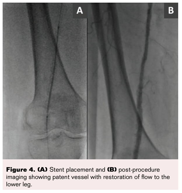 VDM May 2021 Figure 4