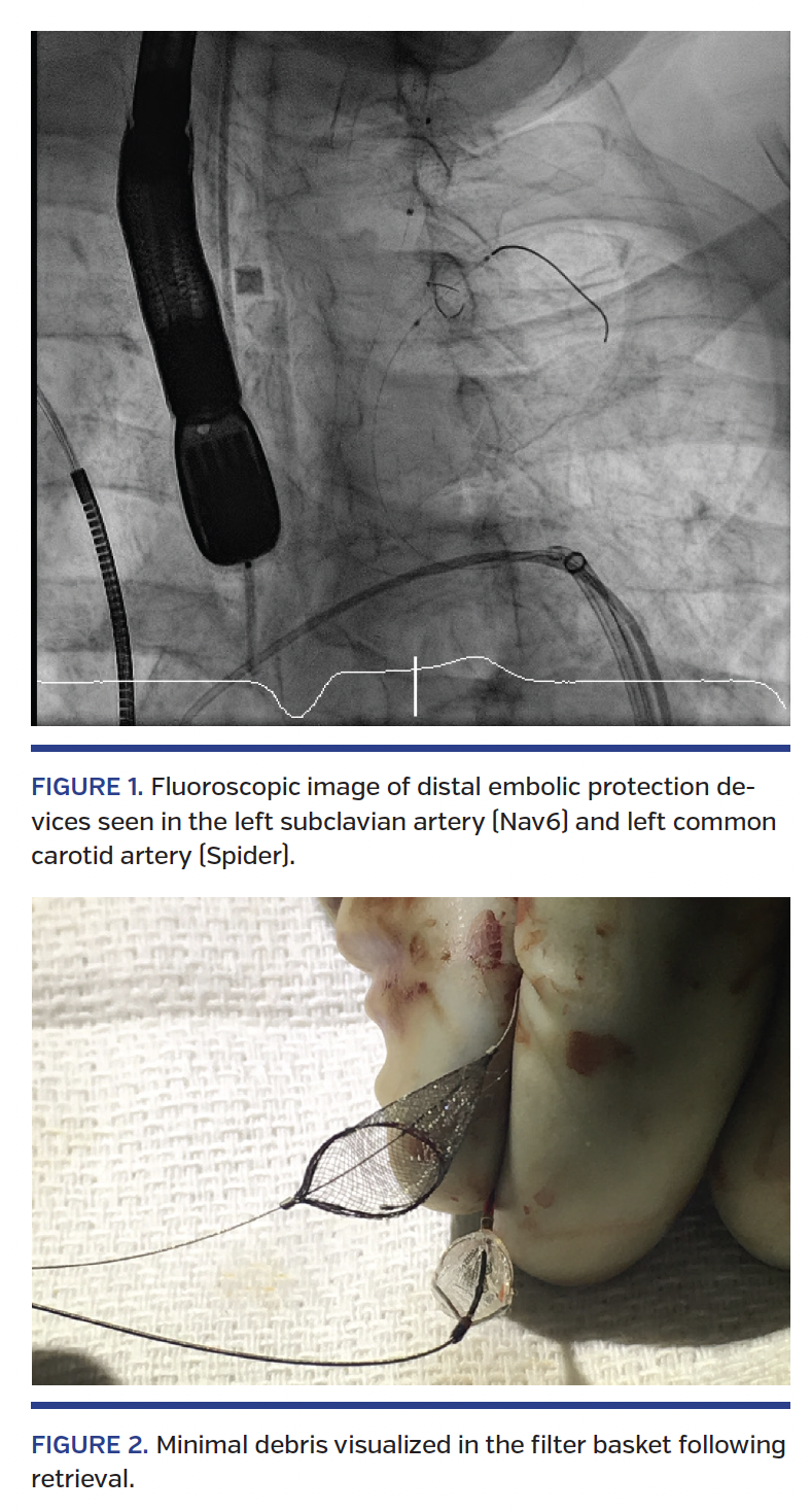 Fluoroscopic image