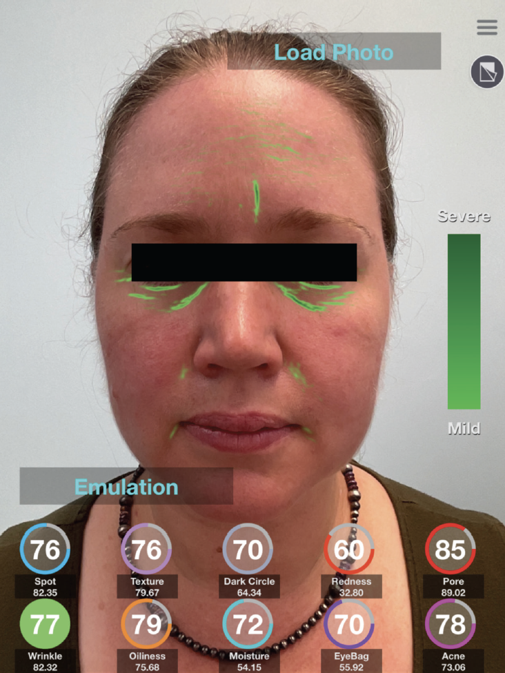 Figure 1. Skin analysis app.