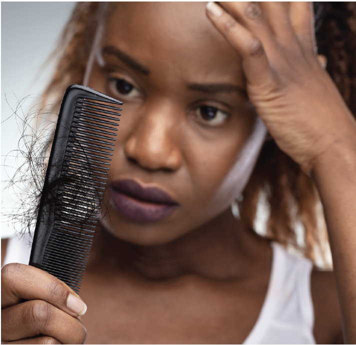 Scalp Examinations for Patients With Skin of Color