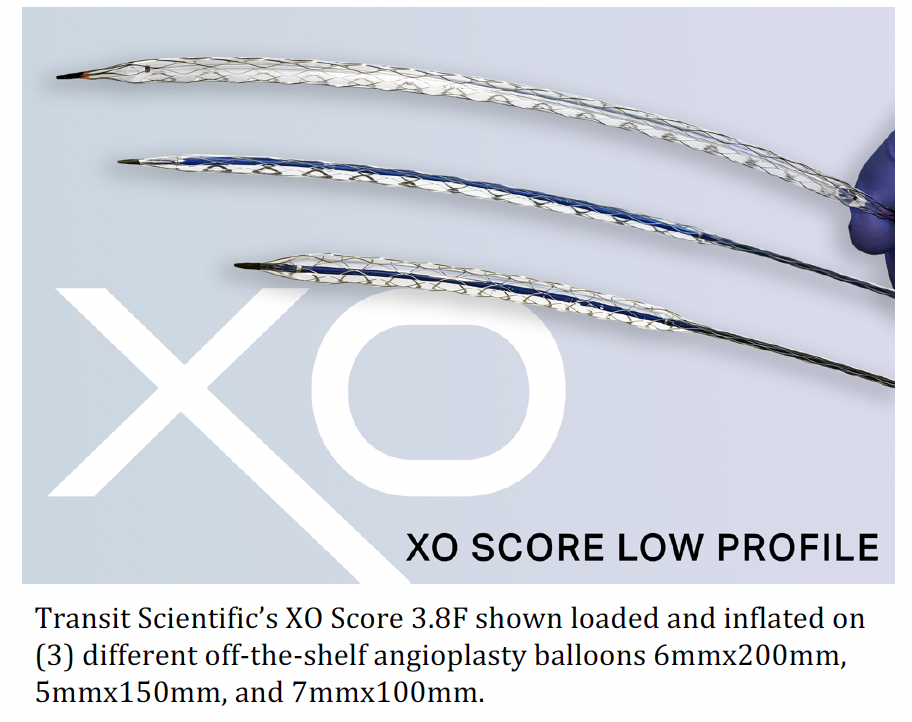 XO Score