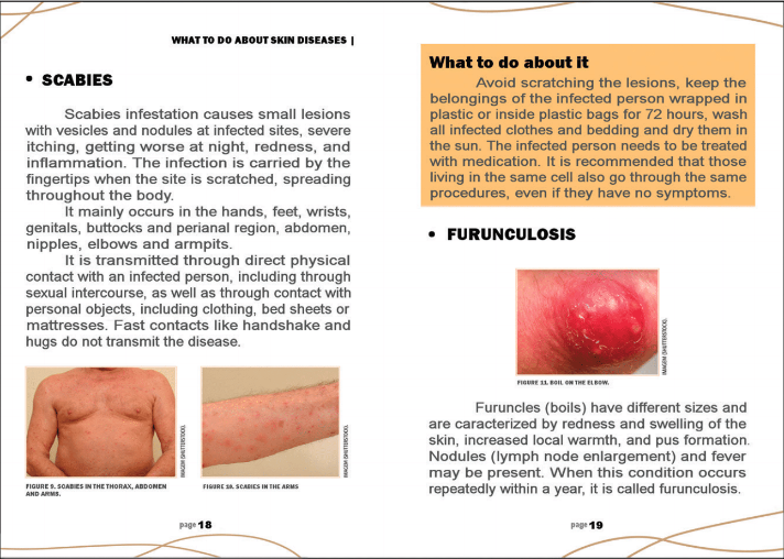 figure 3. Example of the layout of the Manual of Skin Care for Persons De - prived of Liberty in the São Paulo State Prison System , showing the subsection “Scabies” and the partial text for the subsection “Furunculosis” from the chapter, “What to do about skin diseases.”