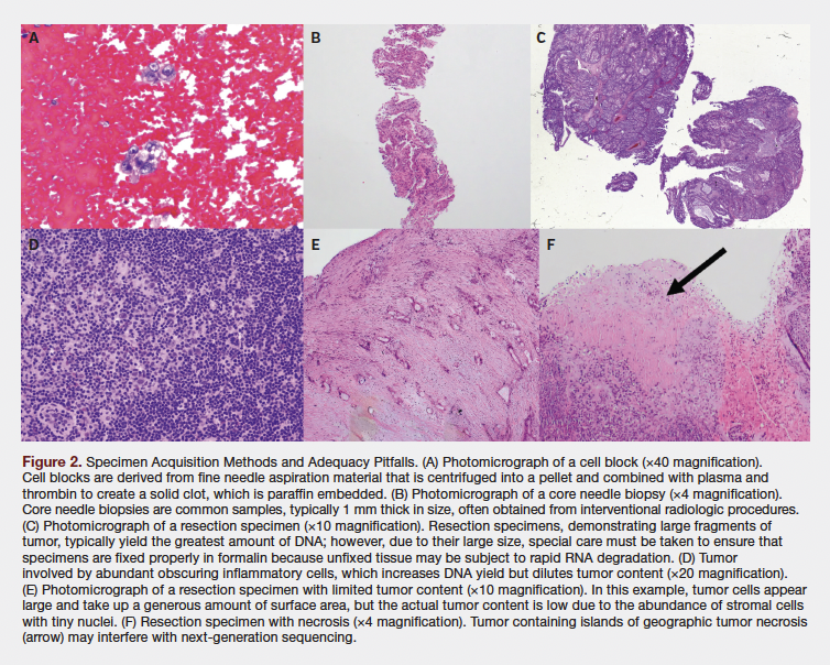 Chart: Specimen Acquisition Methods and Adequacy Pitfalls. 