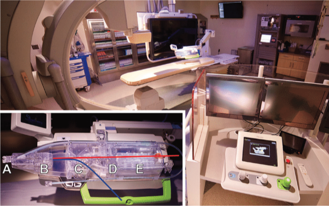FIGURE 1. The CorPath GRX robotic system. The tableside robot - ic drive and interventional cockpit are shown in a cath lab. The interventional cockpit has three individual joystick controls (left: balloon/stent delivery; middle: guidewire; right: guide catheter). Insert: robotic cassette with red line: path for 0.014 ̋ guidewire; blue line: path for balloon/stent catheter; A: sheath retainer; B: guide catheter holder and torque control; C: driver for balloon/ stent catheter; D: driver for 0.014 ̋ guidewire; E: torque control for 0.014 ̋ guidewire